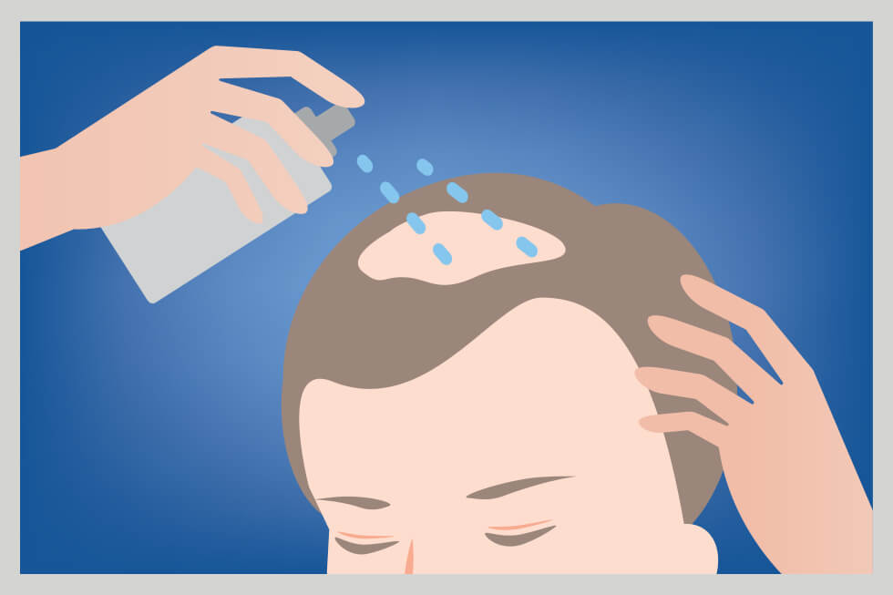 Person applying pump spray product to scalp