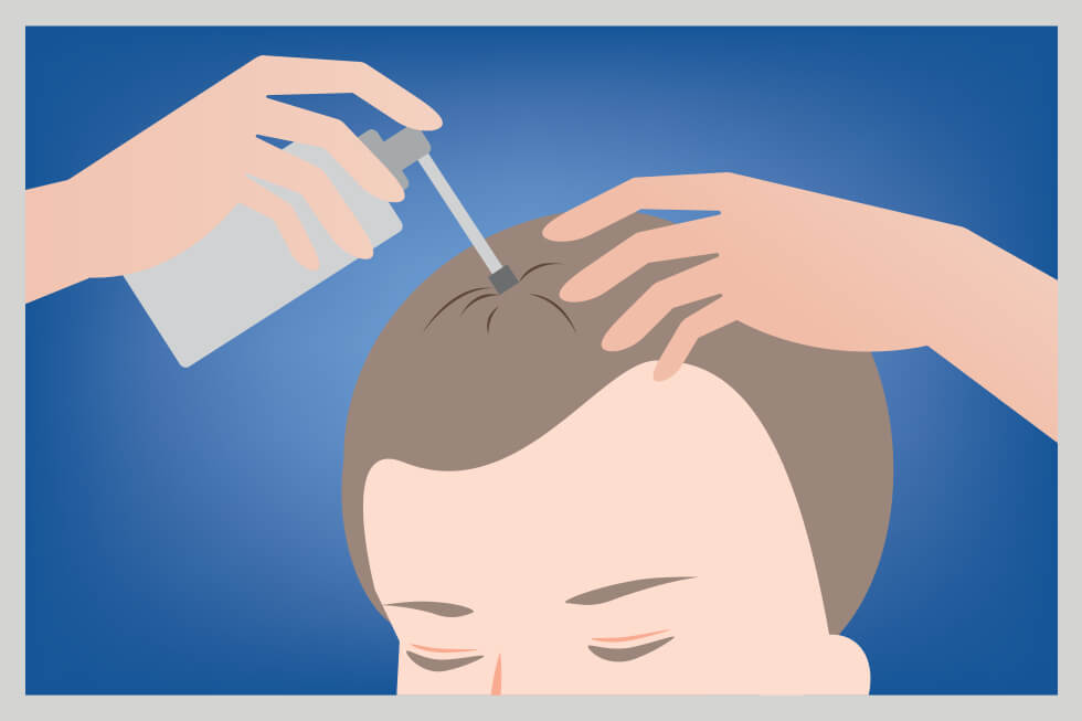 Person spreading and applying product to scalp via spray tip applicator
